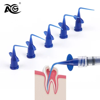 AG DENGT 50/100/200 бр., избелване на зъби, уши за напояване на зъбите, синьо еднократна съвет за спринцовка, накрайници за напояване на зъбите